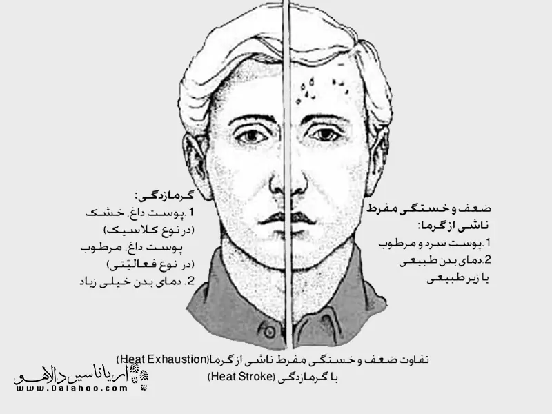 گرمازدگی در مناطق گرمسیری بیشتر به چشم می‌خورد. هم‌چنین مردان بیش از زنان مستعد ابتلای به گرمازدگی هستند.