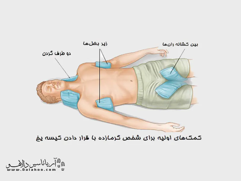 تکنیک هایی برای خنک کردن فرد  گرما زده.